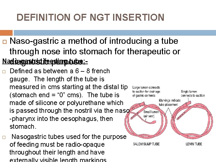 DEFINITION OF NGT INSERTION Naso-gastric a method of introducing a tube through nose into