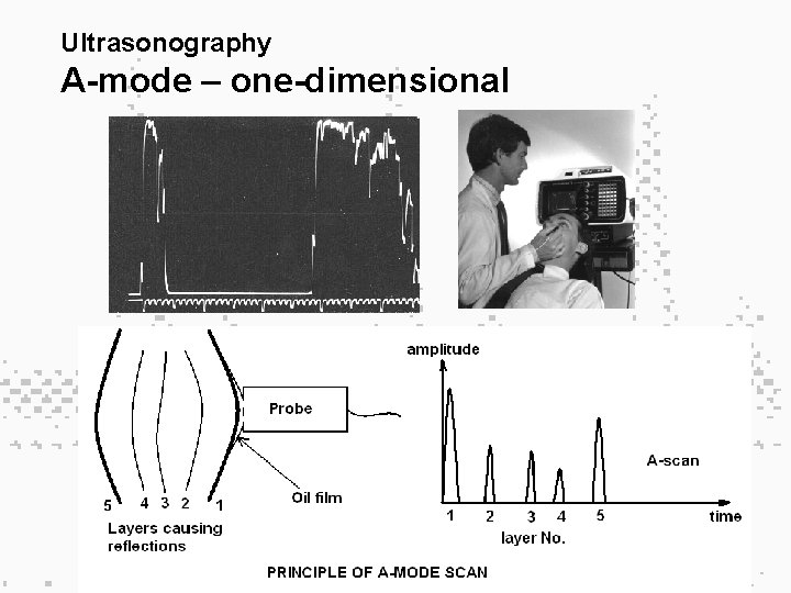Ultrasonography A-mode – one-dimensional 19 