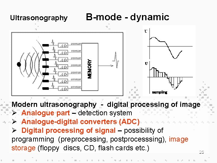 B-mode - dynamic MEMORY Ultrasonography sampling Modern ultrasonography - digital processing of image Ø