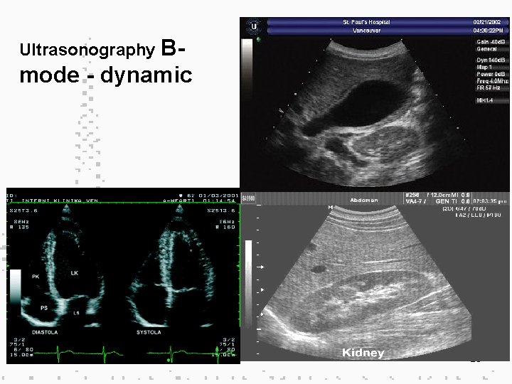 Ultrasonography B- mode - dynamic 26 