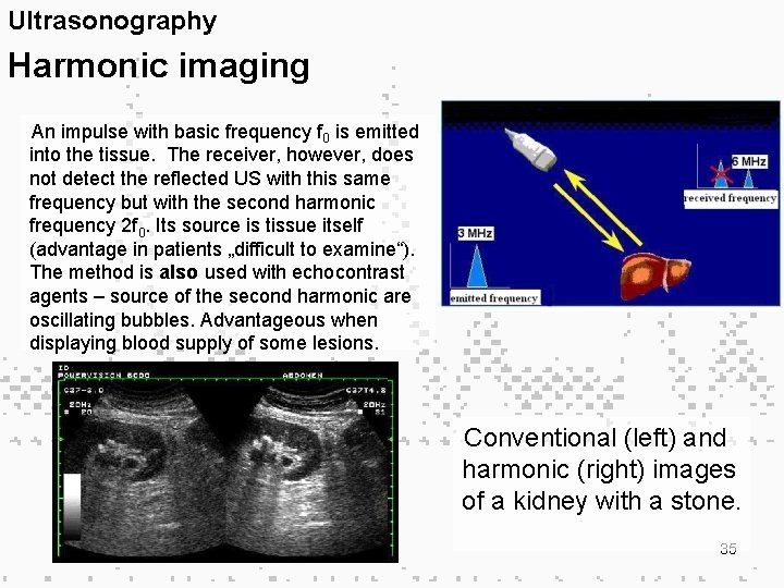 Ultrasonography Harmonic imaging An impulse with basic frequency f 0 is emitted into the