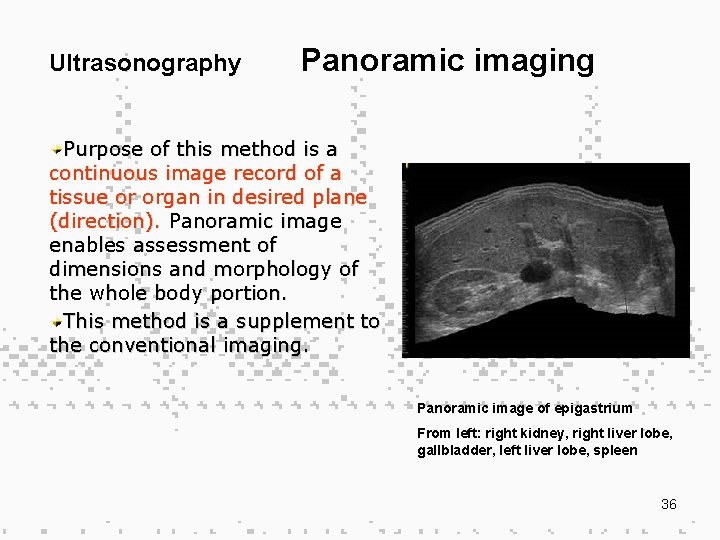 Ultrasonography Panoramic imaging Purpose of this method is a continuous image record of a