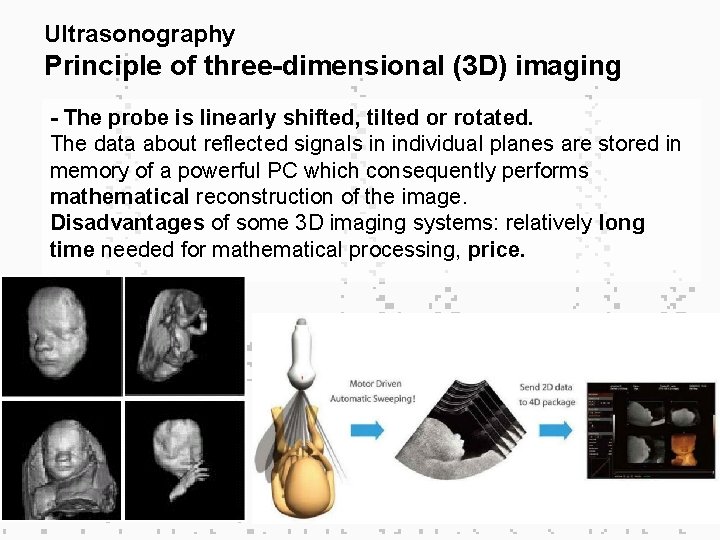 Ultrasonography Principle of three-dimensional (3 D) imaging - The probe is linearly shifted, tilted