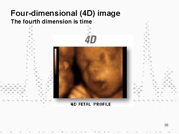 Four-dimensional (4 D) image The fourth dimension is time 38 