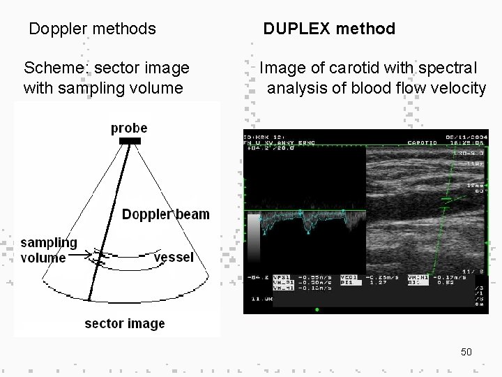 Doppler methods Scheme: sector image with sampling volume DUPLEX method Image of carotid with