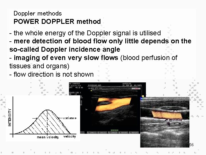 Doppler methods POWER DOPPLER method - the whole energy of the Doppler signal is