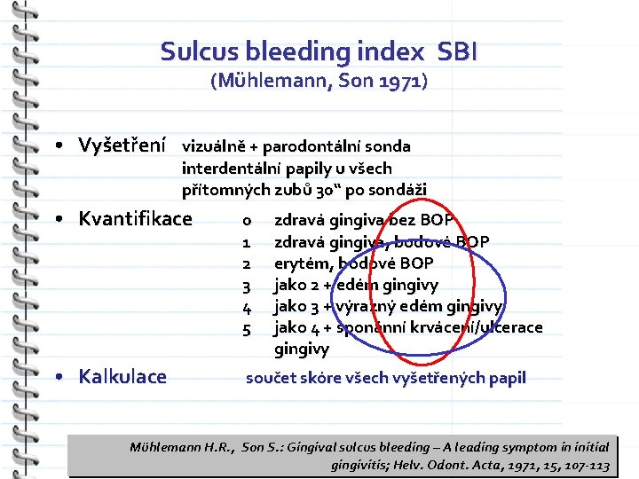Sulcus bleeding index SBI (Mühlemann, Son 1971) • Vyšetření vizuálně + parodontální sonda interdentální