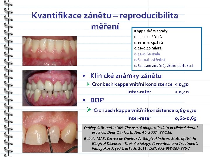 Kvantifikace zánětu – reproducibilita měření Kappa skóre shody 0. 00– 0. 10 žádná 0.