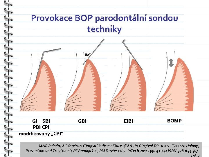 Provokace BOP parodontální sondou techniky 60 o GI SBI PBI CPI modifikovaný „CPI“ GBI