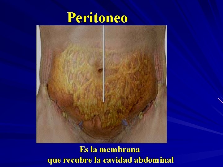 Peritoneo Es la membrana que recubre la cavidad abdominal 