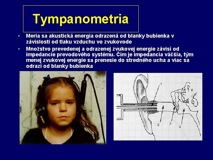 Tympanometria • • Meria sa akustická energia odrazená od blanky bubienka v závislosti od