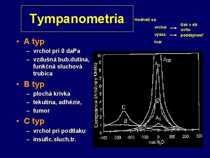 Tympanometria • A typ – vrchol pri 0 da. Pa – vzdušná bub. dutina,