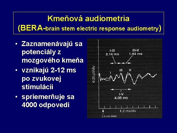 Kmeňová audiometria (BERA-brain stem electric response audiometry) • Zaznamenávajú sa potenciály z mozgového kmeňa