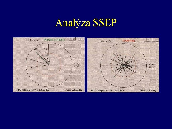 Analýza SSEP 