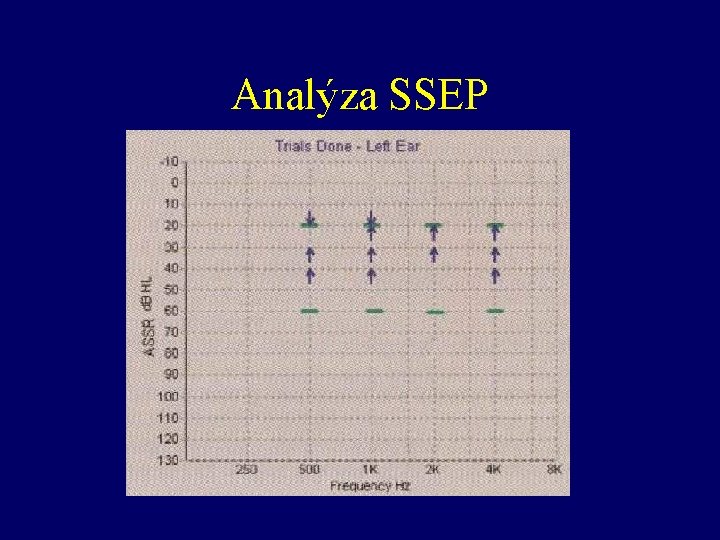 Analýza SSEP 