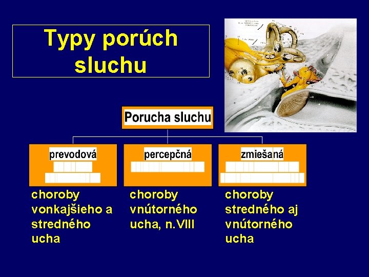 Typy porúch sluchu choroby vonkajšieho a stredného ucha choroby vnútorného ucha, n. VIII choroby