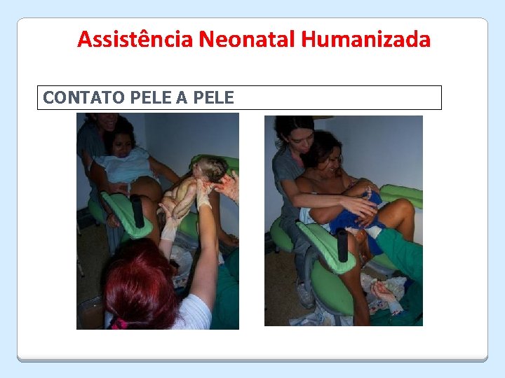 Assistência Neonatal Humanizada CONTATO PELE A PELE 