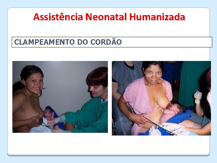 Assistência Neonatal Humanizada CLAMPEAMENTO DO CORDÃO 