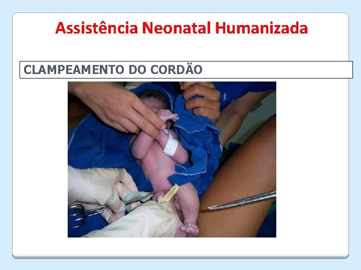 Assistência Neonatal Humanizada CLAMPEAMENTO DO CORDÃO 