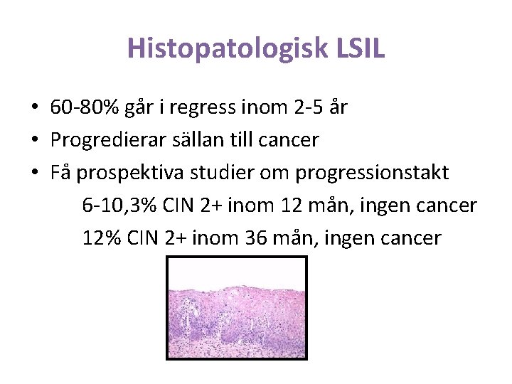 Histopatologisk LSIL • 60 -80% går i regress inom 2 -5 år • Progredierar