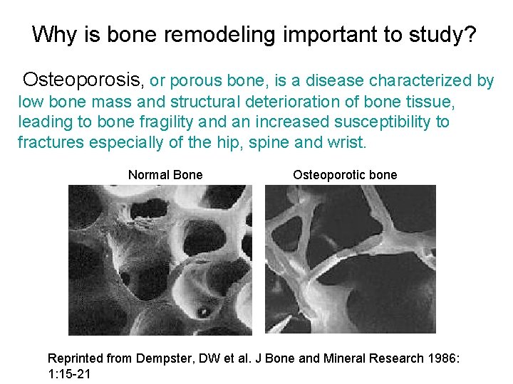Why is bone remodeling important to study? Osteoporosis, or porous bone, is a disease