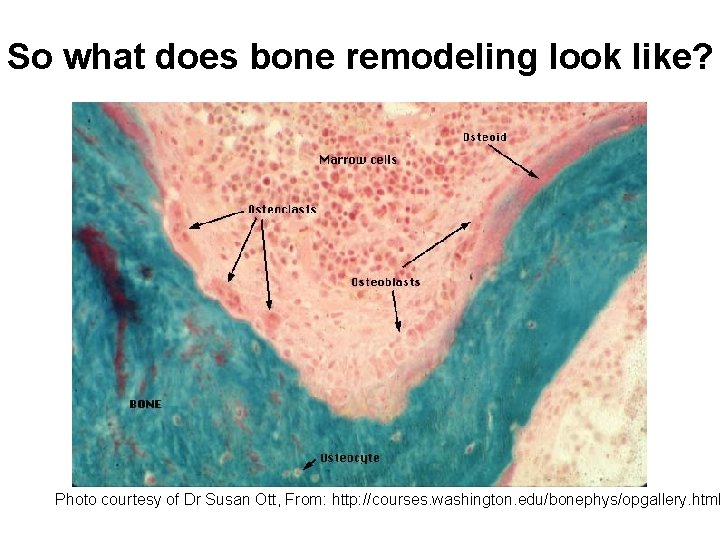 So what does bone remodeling look like? Photo courtesy of Dr Susan Ott, From: