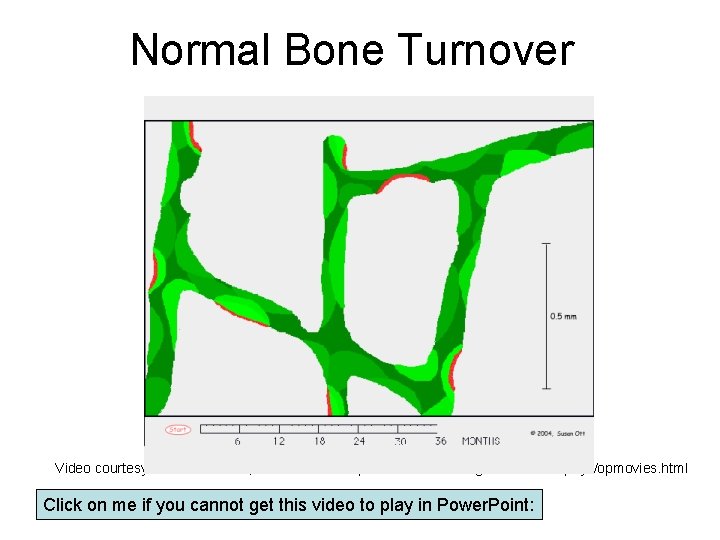 Normal Bone Turnover Video courtesy of Dr Susan Ott, from website: http: //courses. washington.