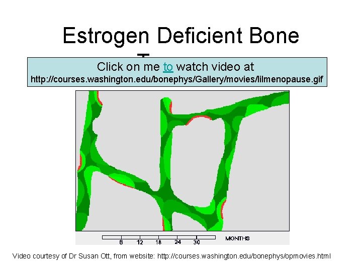 Estrogen Deficient Bone Turnover Click on me to watch video at http: //courses. washington.