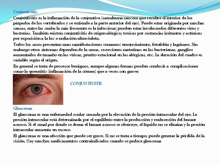 L Conjuntivitis es la inflamación de la conjuntiva (membrana mucosa que recubre el interior