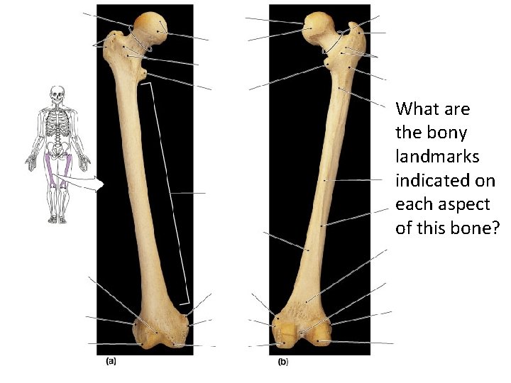 What are the bony landmarks indicated on each aspect of this bone? 