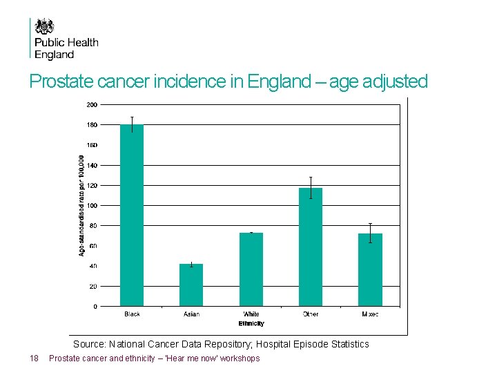 Prostate cancer incidence in England – age adjusted Source: National Cancer Data Repository; Hospital