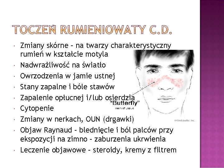  Zmiany skórne – na twarzy charakterystyczny rumień w kształcie motyla Nadwrażliwość na światło