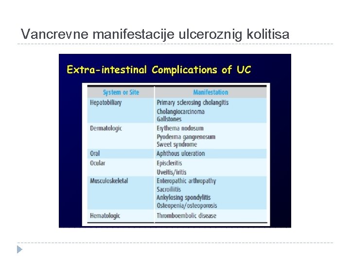 Vancrevne manifestacije ulceroznig kolitisa 