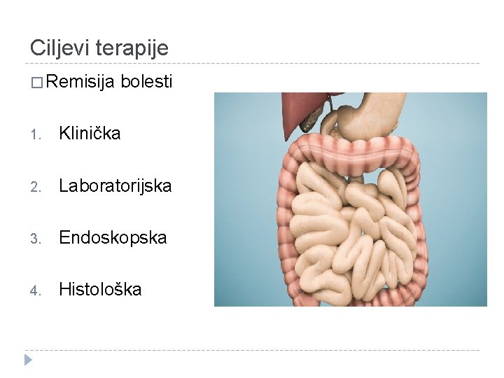 Ciljevi terapije � Remisija bolesti 1. Klinička 2. Laboratorijska 3. Endoskopska 4. Histološka Ciljevi terapije � Remisija bolesti 1. Klinička 2. Laboratorijska 3. Endoskopska 4. Histološka