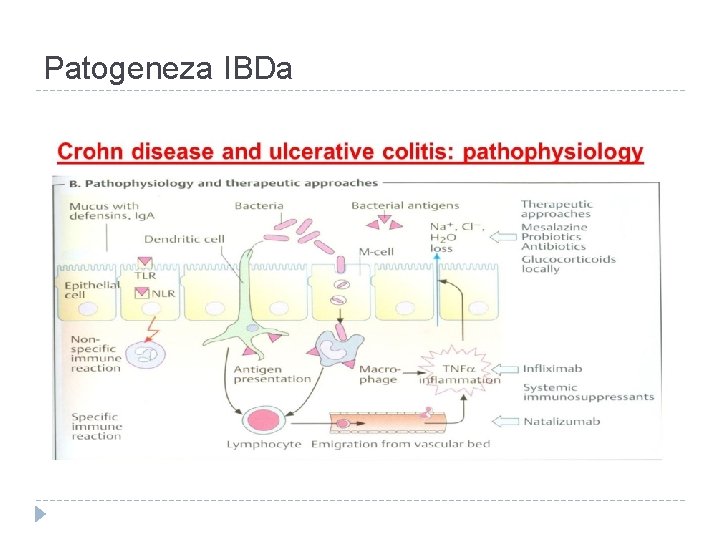Patogeneza IBDa 