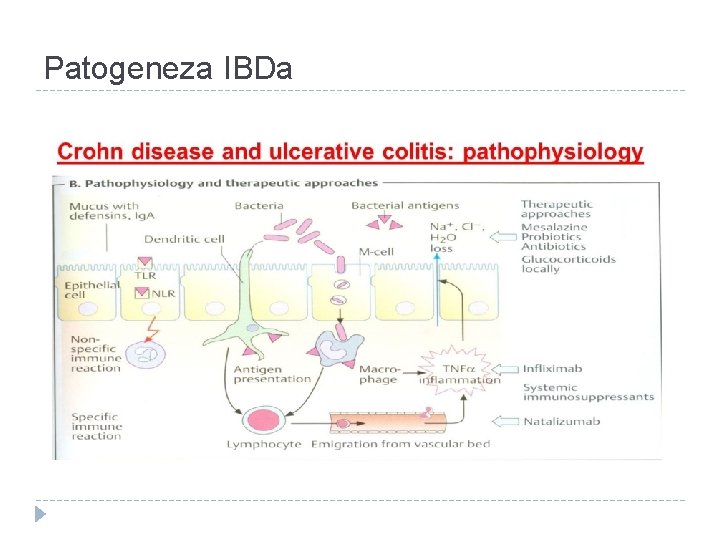 Patogeneza IBDa Patogeneza IBDa