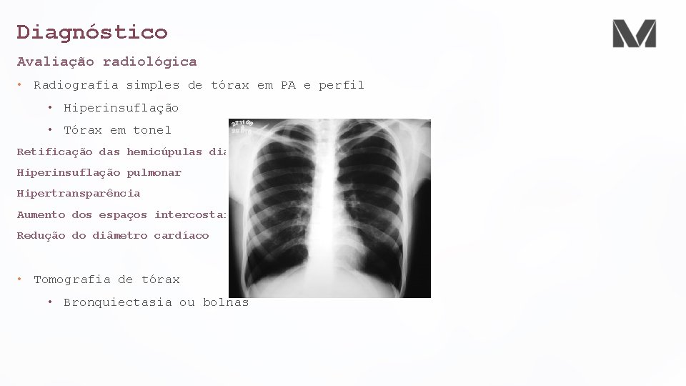 Diagnóstico Avaliação radiológica • Radiografia simples de tórax em PA e perfil • Hiperinsuflação