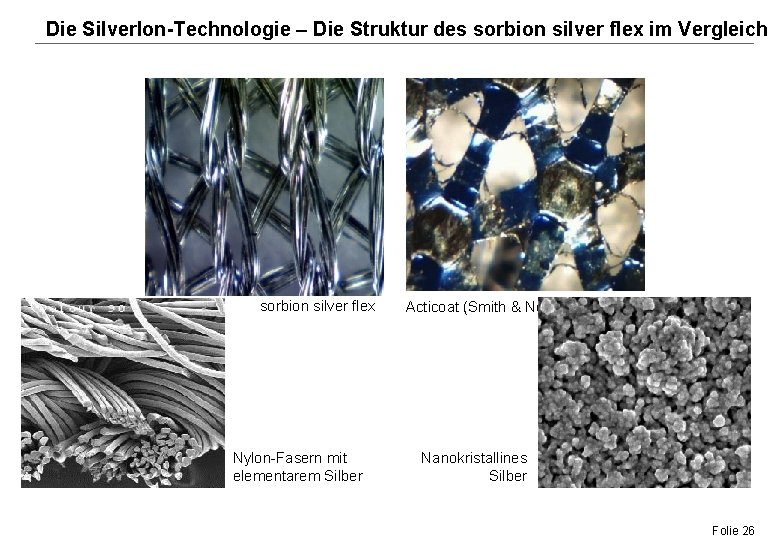 Die Silverlon-Technologie – Die Struktur des sorbion silver flex im Vergleich sorbion silver flex