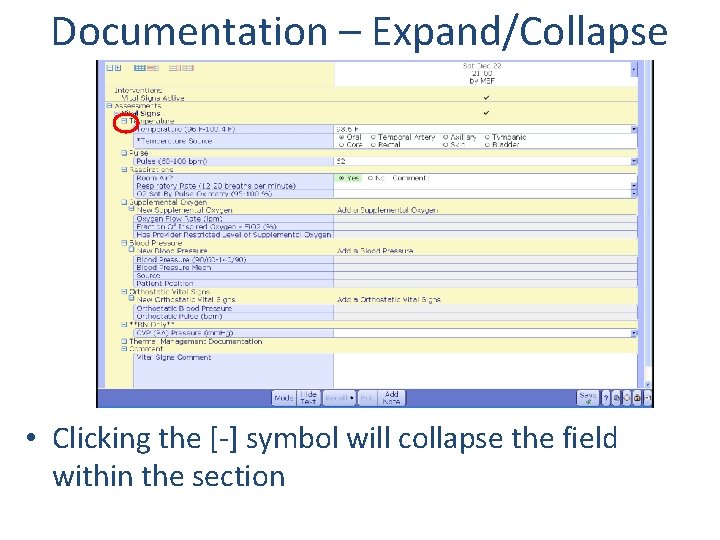 Documentation – Expand/Collapse • Clicking the [-] symbol will collapse the field within the