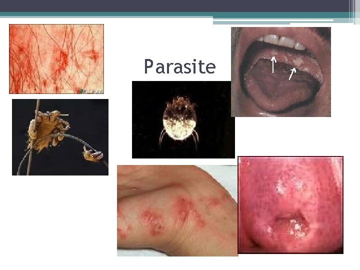 Parasite 