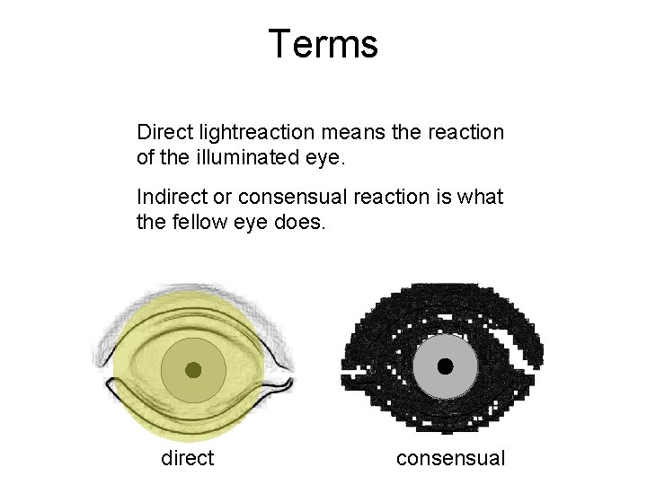 Terms Direct lightreaction means the reaction of the illuminated eye. Indirect or consensual reaction