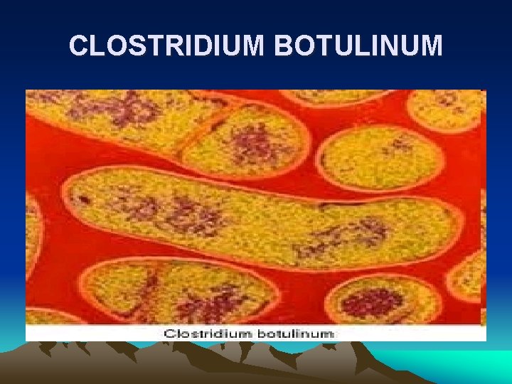 CLOSTRIDIUM BOTULINUM 