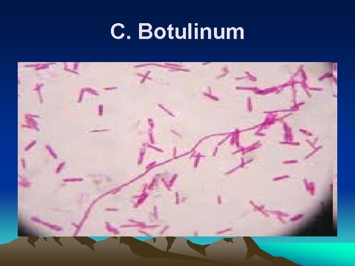 C. Botulinum C. Botulinum