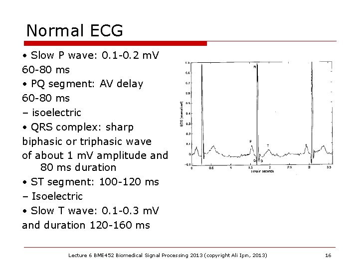 Normal ECG • Slow P wave: 0. 1 -0. 2 m. V 60 -80