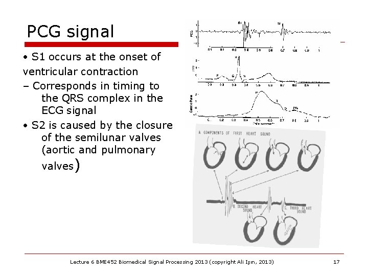 PCG signal • S 1 occurs at the onset of ventricular contraction – Corresponds