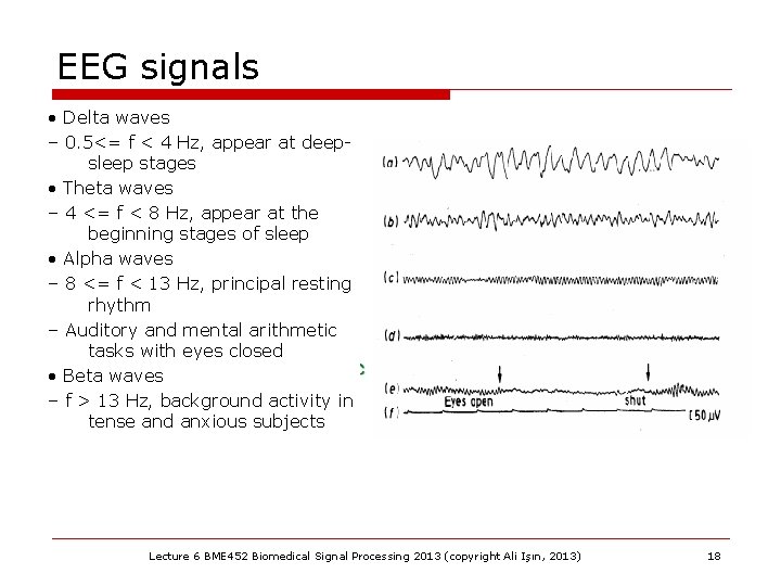 EEG signals • Delta waves – 0. 5<= f < 4 Hz, appear at