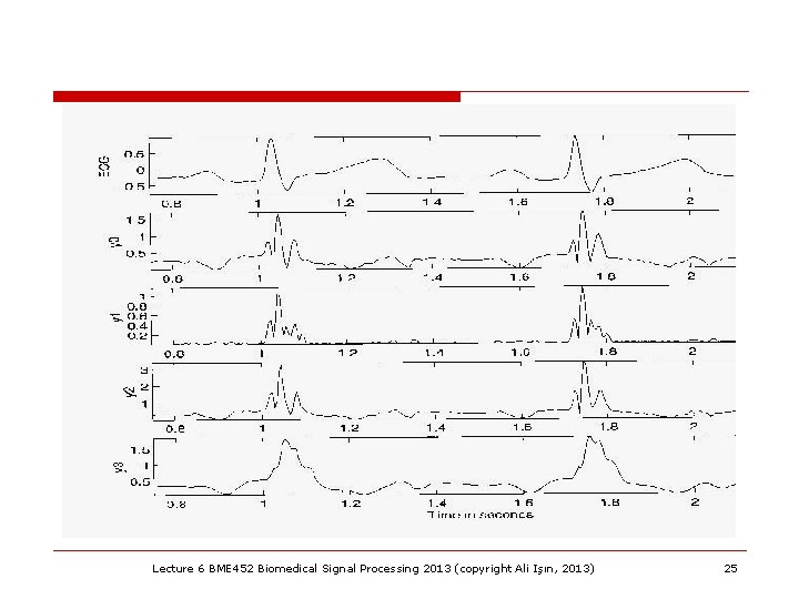 Lecture 6 BME 452 Biomedical Signal Processing 2013 (copyright Ali Işın, 2013) 25 