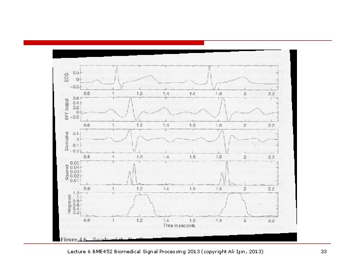 Lecture 6 BME 452 Biomedical Signal Processing 2013 (copyright Ali Işın, 2013) 33 