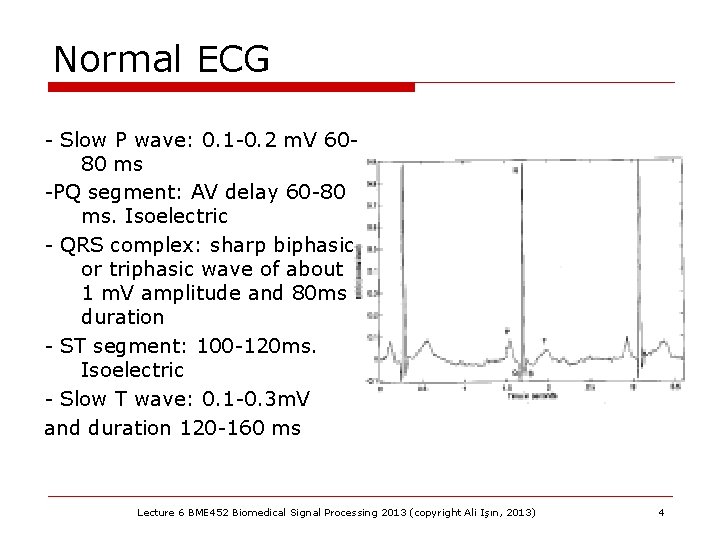 Normal ECG - Slow P wave: 0. 1 -0. 2 m. V 6080 ms