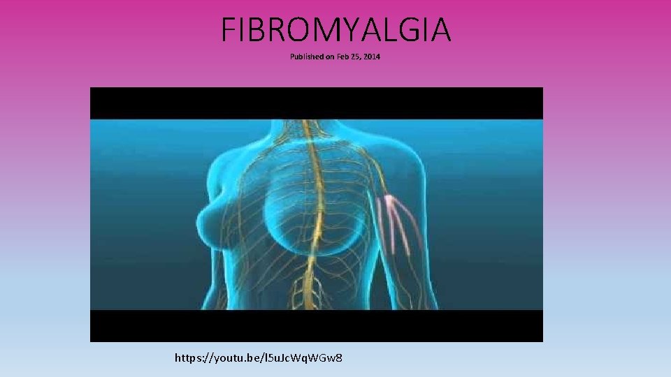 FIBROMYALGIA Published on Feb 25, 2014 https: //youtu. be/l 5 u. Jc. Wq. WGw
